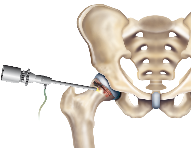 Technique demonstration